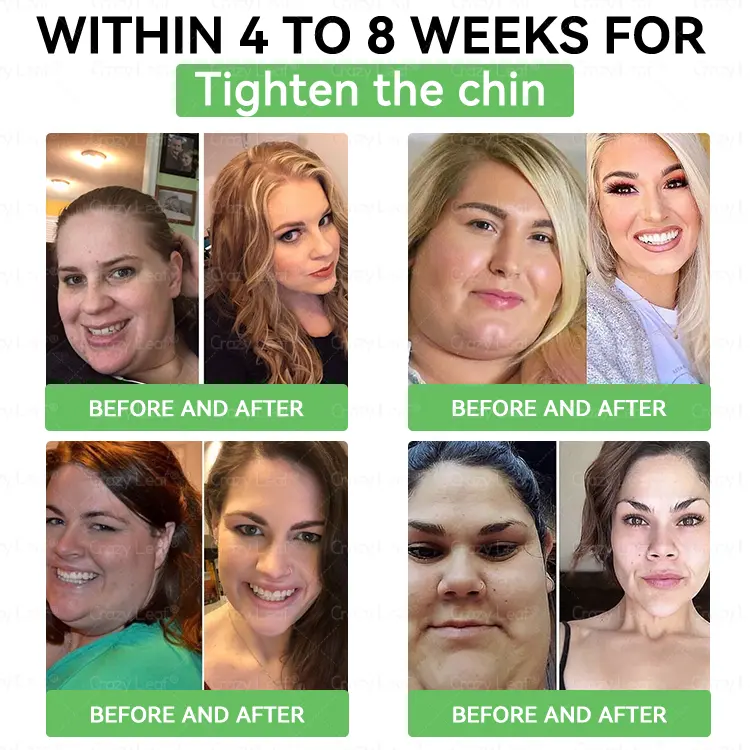 ๐ฎ๐๐บ๐
๐olution - Image 5