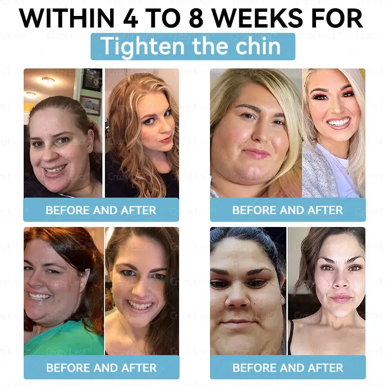 ๐ฎ๐๐บ๐
๐ฒ๐๐
๐๐๐๐๐ - Image 10