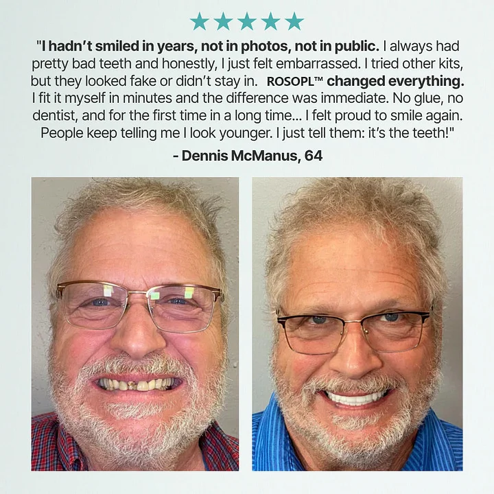 Custom Dentures for a Perfect, Confident Smile! - Image 5