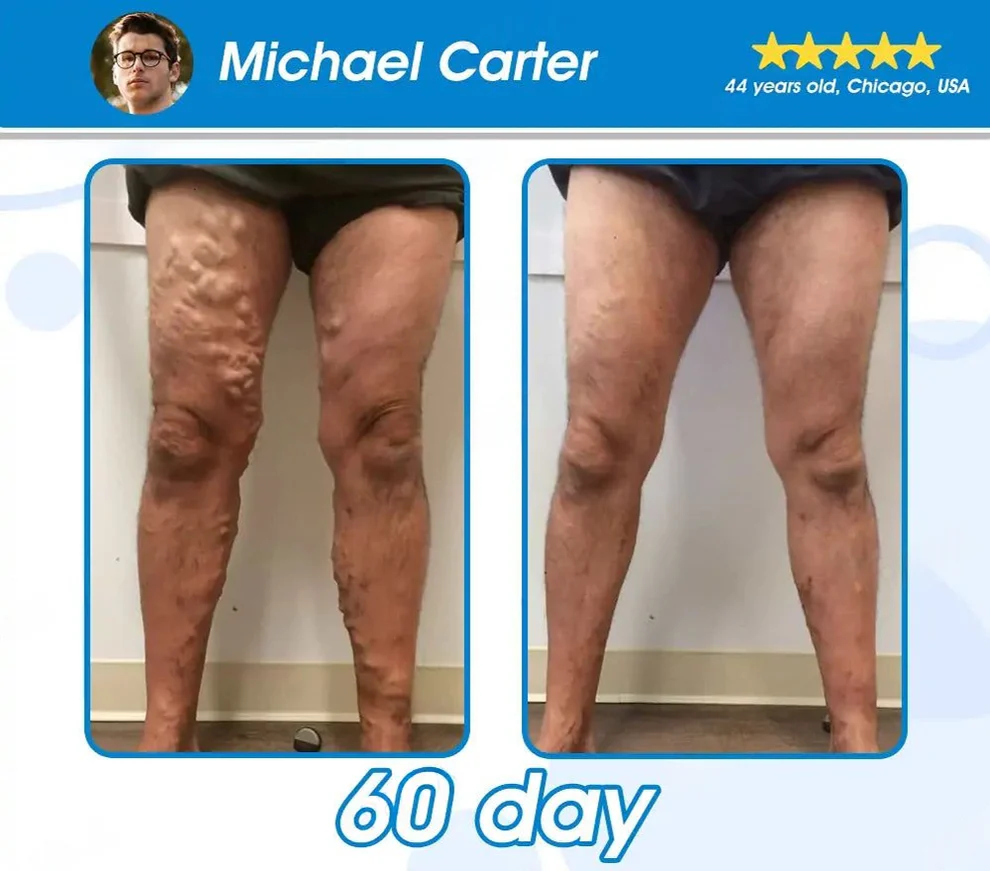 Liquid Pearls - Image 7