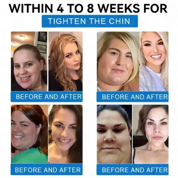 ๐๐๐ง๐จ ๐๐ข๐๐ซ๐จ๐ง๐๐๐๐ฅ๐ ๐๐๐ข๐ ๐ก๐ญ ๐๐จ๐ฌ๐ฌ ๐๐๐ญ๐๐ก - Image 6