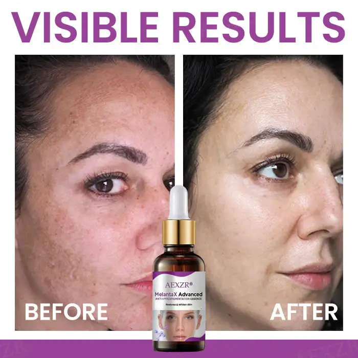 Advanced Anti-Hyperpigmentation Essence - Image 5