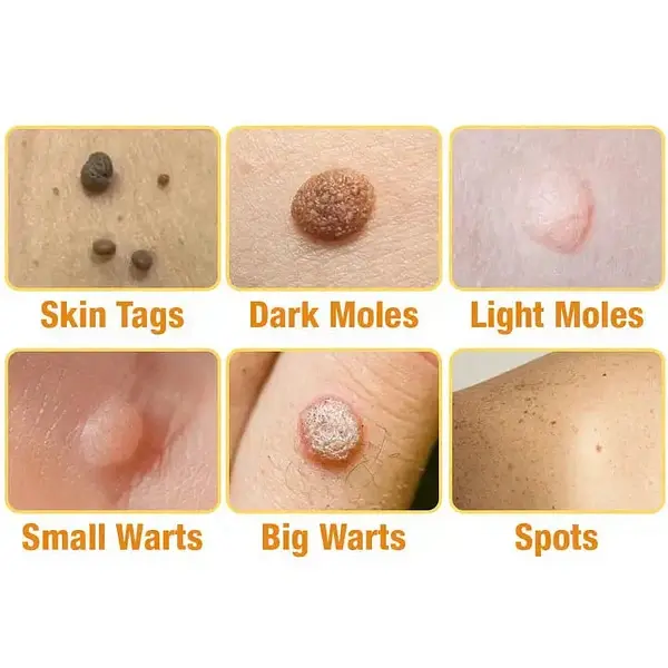 TagRecede Bee Venom Treatment Spray - Image 5