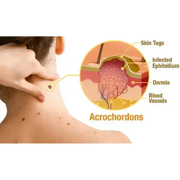 TagRecede Bee Venom Treatment Spray - Image 6