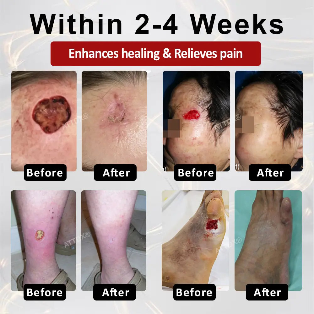 GlucoseGuard Skin Rescue Cream - Image 6