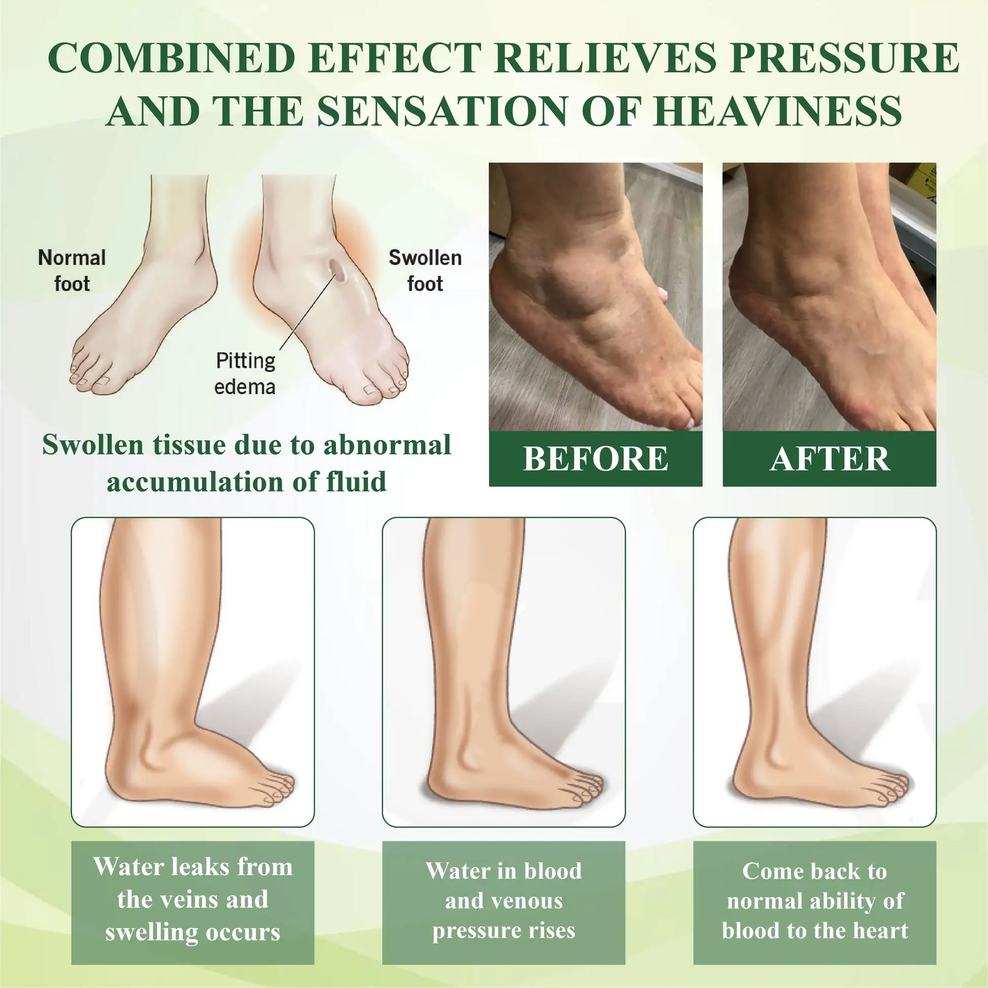 PuffyGone Horse Chestnut Edema Cream - Image 4