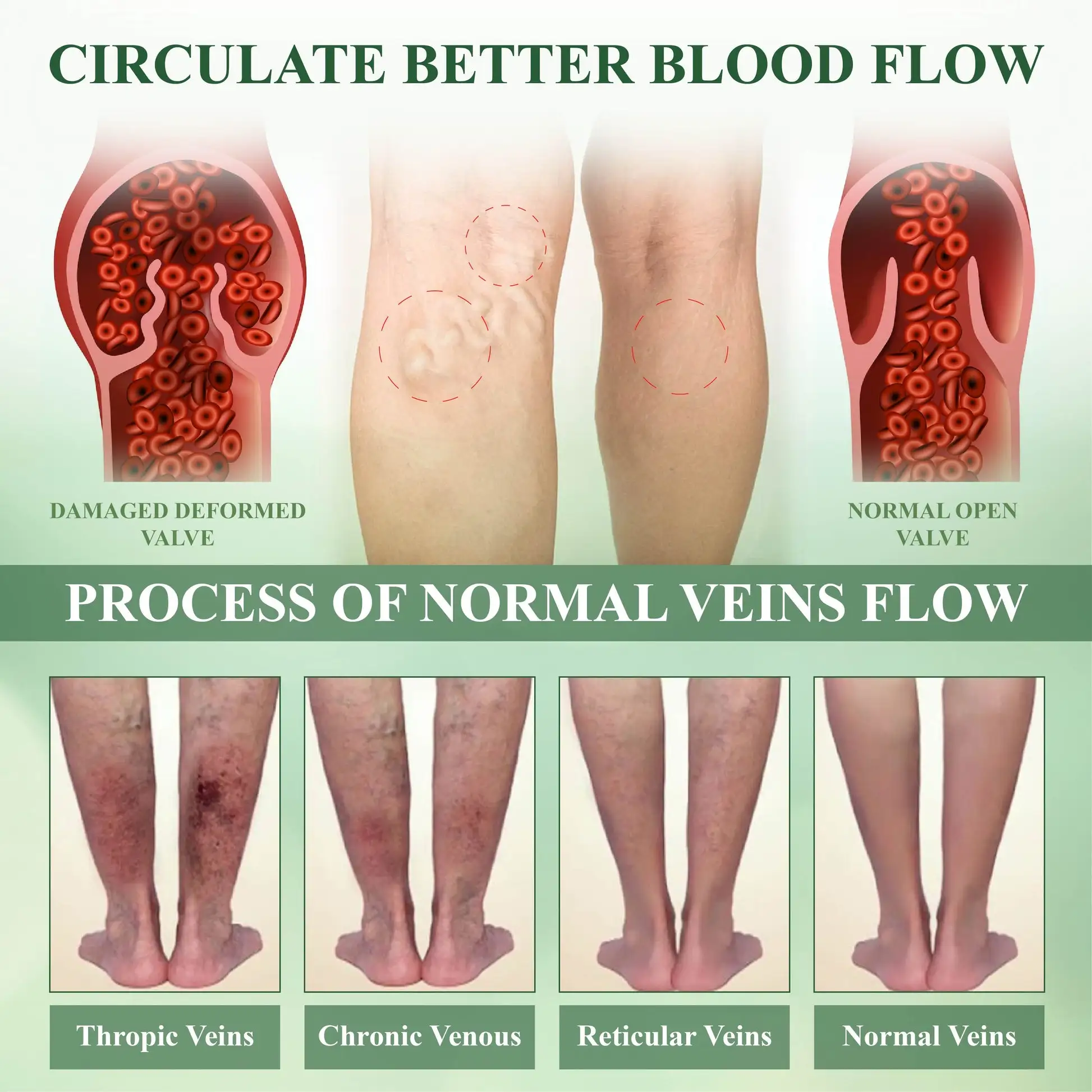 PuffyGone Horse Chestnut Edema Cream - Image 6