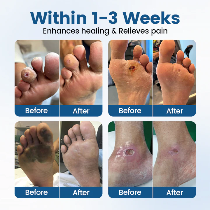 AngioVita Diabetic Care Spray - Image 5