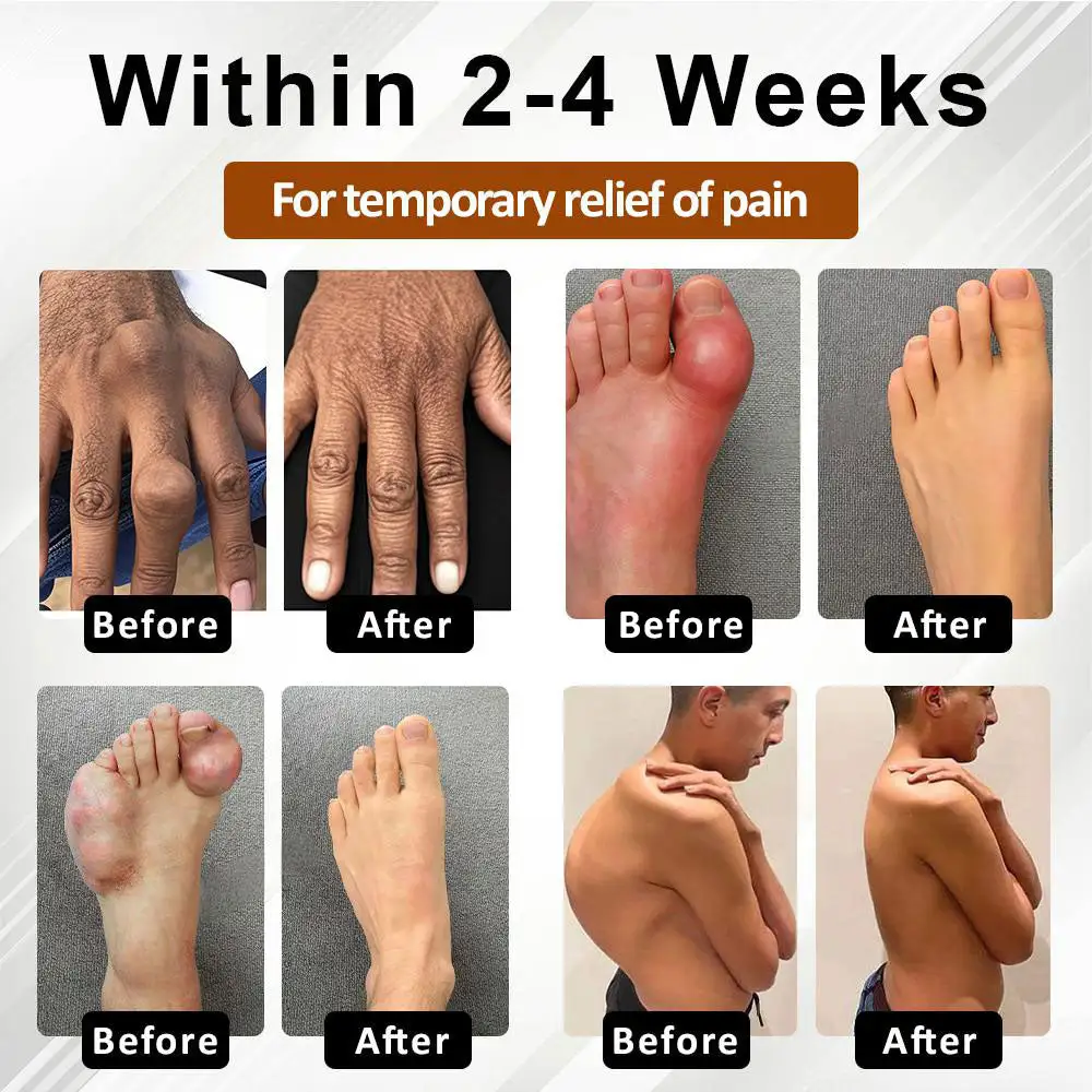 Joint Support Formula Spray - Image 2