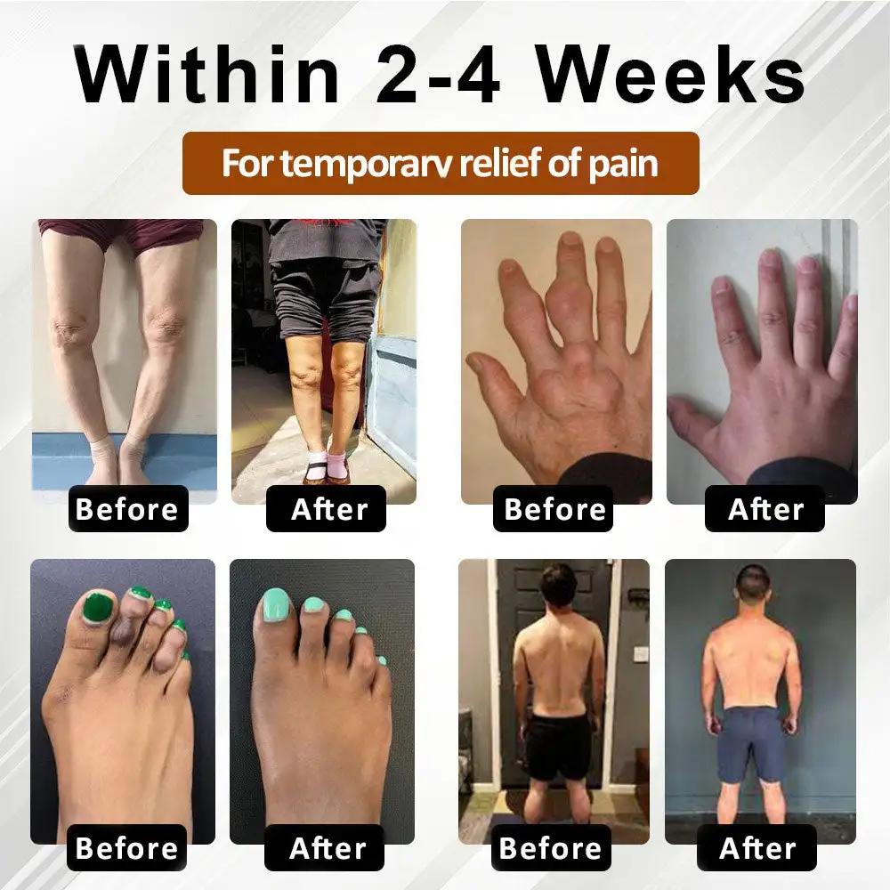 Joint Support Formula Spray - Image 3