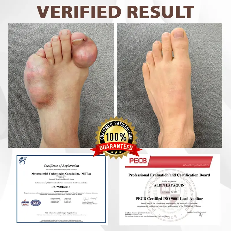 Joint Support Formula Spray - Image 6