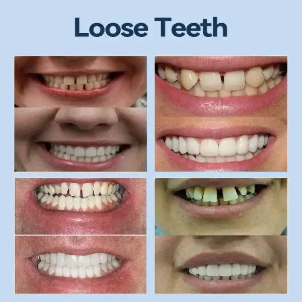 𝐏𝐫𝐞𝐦𝐢𝐮𝐦 𝐃𝐞𝐧𝐭𝐮𝐫𝐞 - Image 6