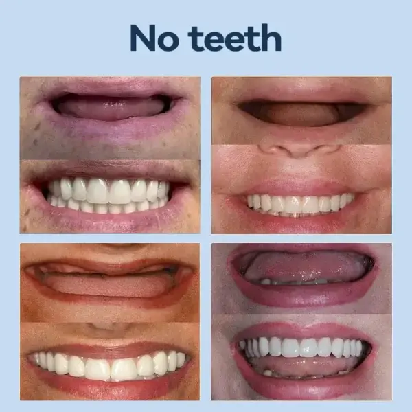 𝐏𝐫𝐞𝐦𝐢𝐮𝐦 𝐃𝐞𝐧𝐭𝐮𝐫𝐞 - Image 7