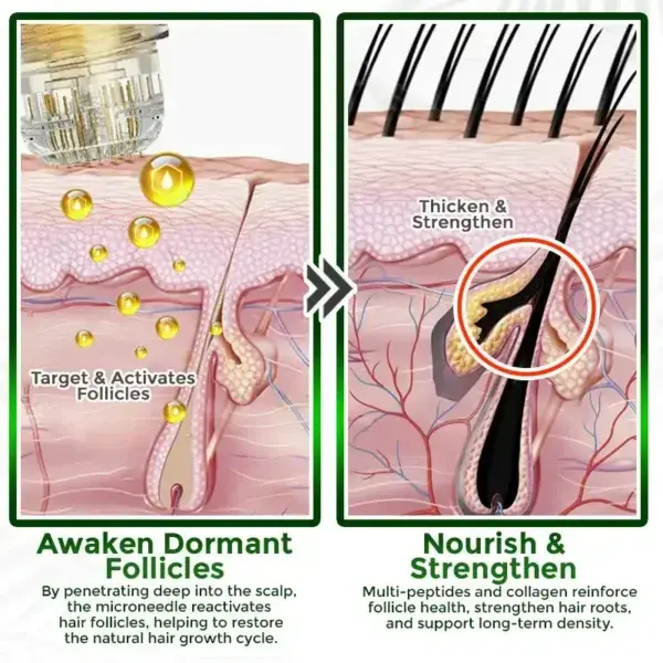 Herbal Infusion Hair Stimulation Set - Image 6