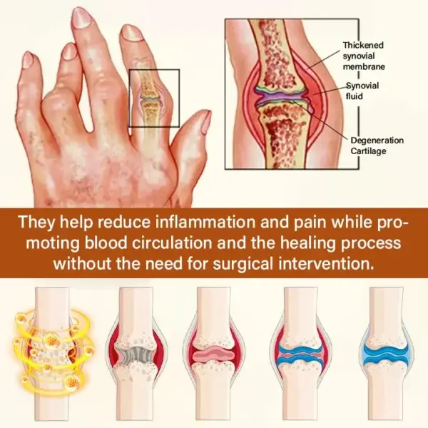 VenomEase Joint Cream - Image 8