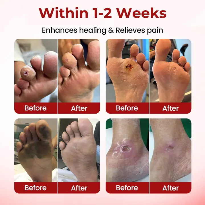 Care Cream - Image 8