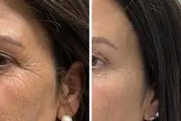 Eye Serum Capsules - Image 15