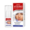 Vitiligo Treatment Spray