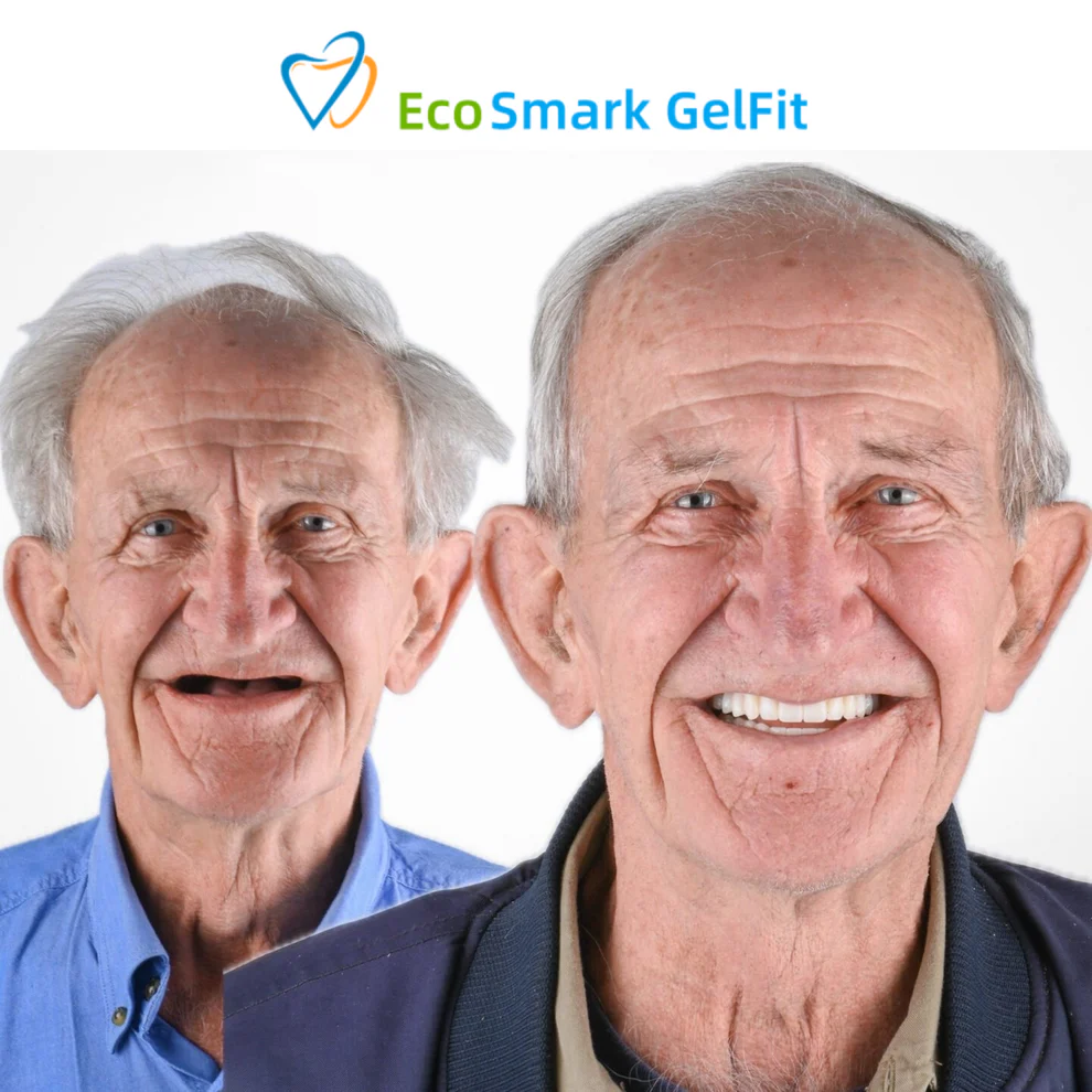 GelFit Dentures - Image 4