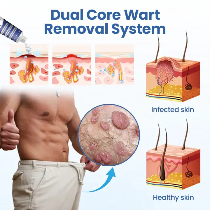 WartRelief Cream - Image 9