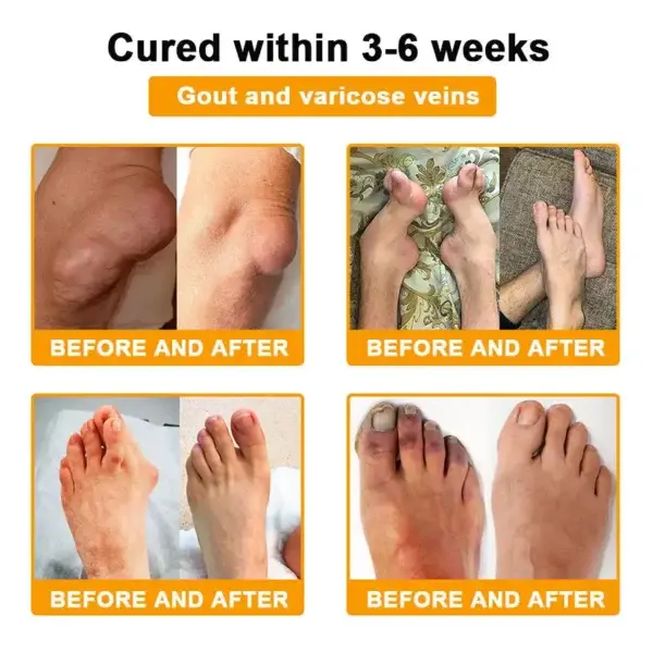 Pain-Relief Bone Healing Cream - Image 9