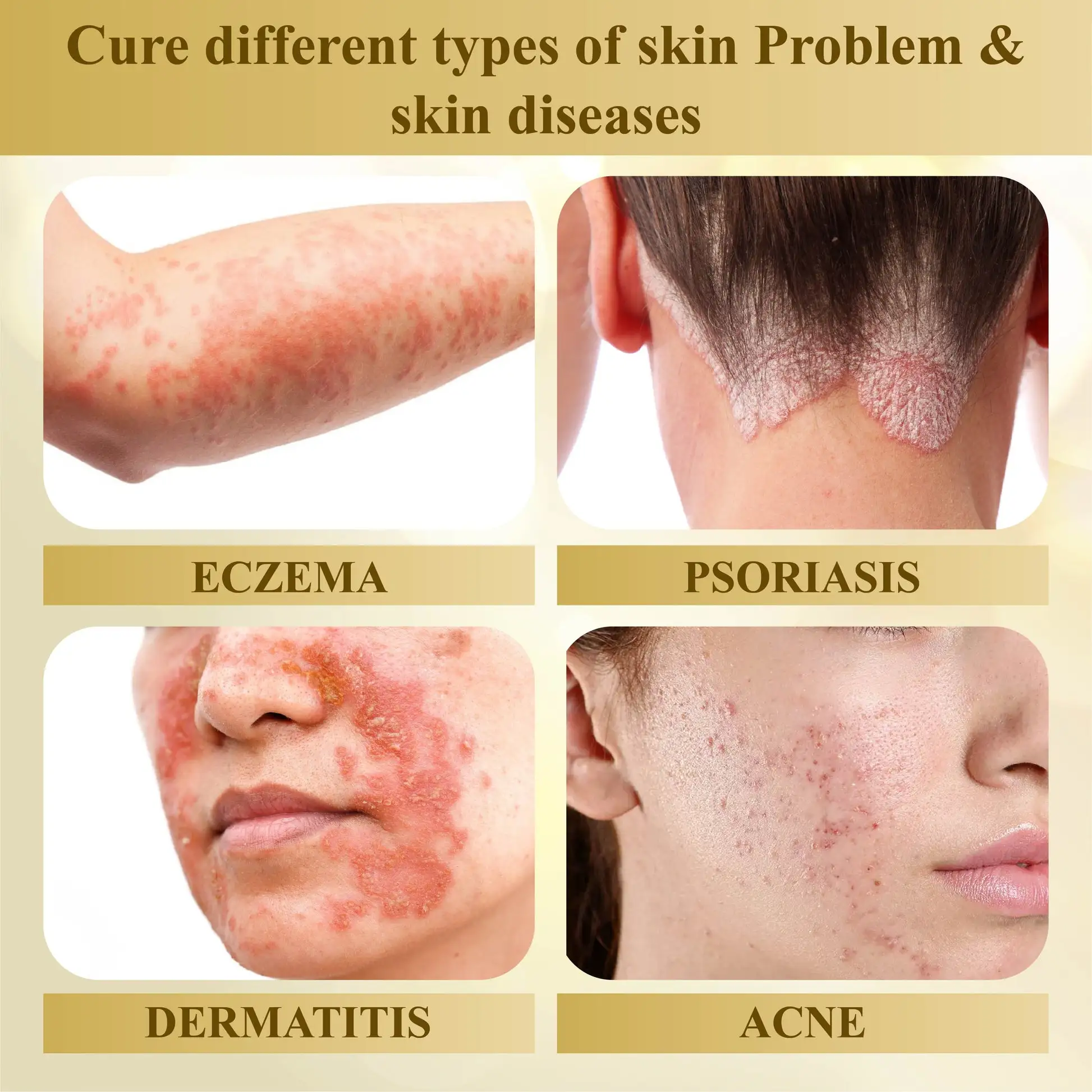 Venom Skin Repairing Cream - Image 12