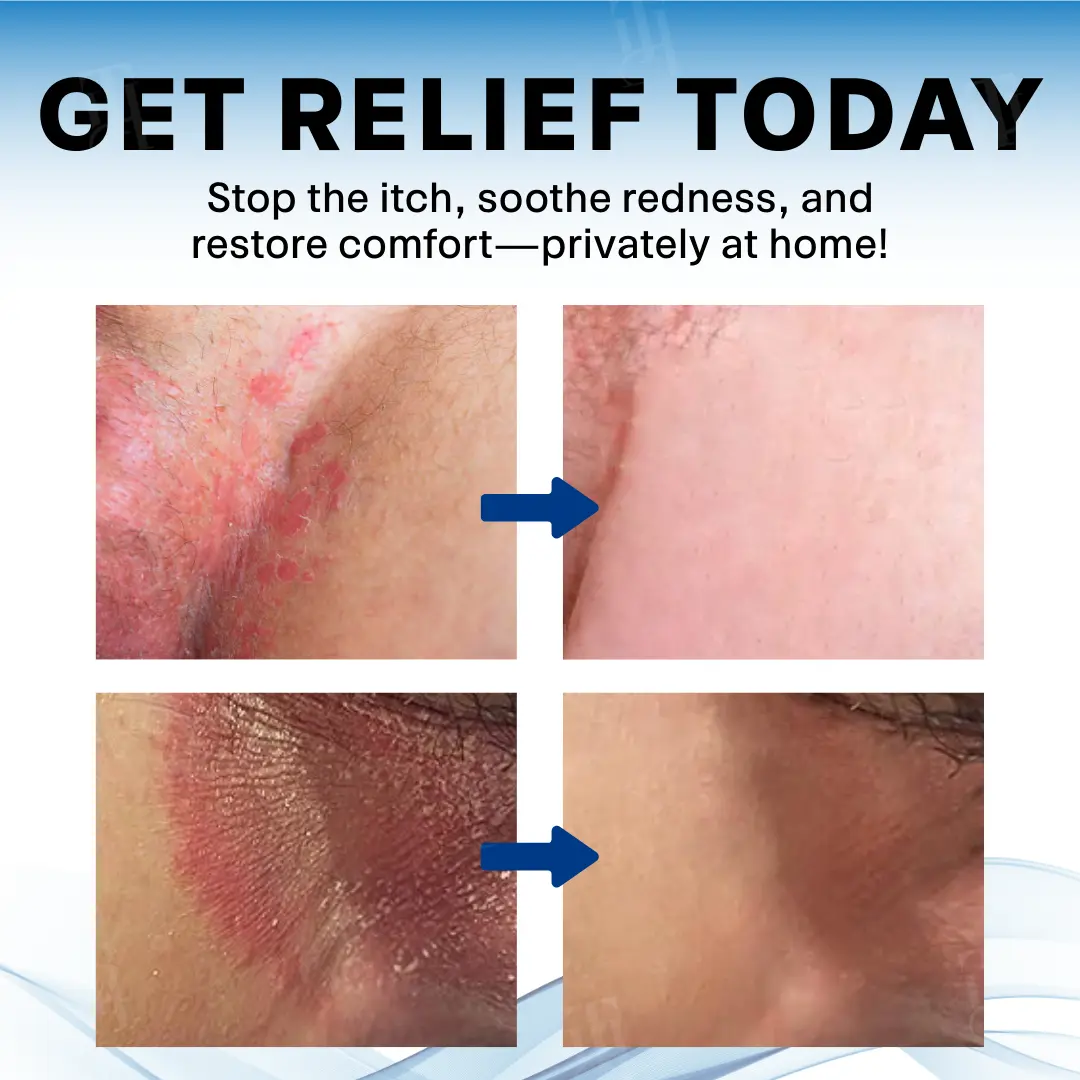 Scrotum Itchy Treatment Cream - Image 5