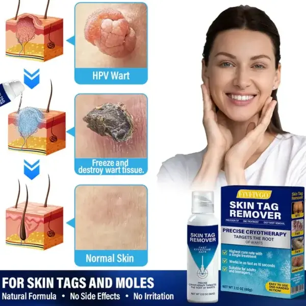 TagRecede Cryo Treatment Spray - Image 2