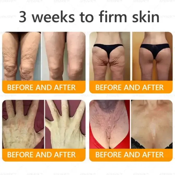 Bee venom Comprehensive Cream - Image 5