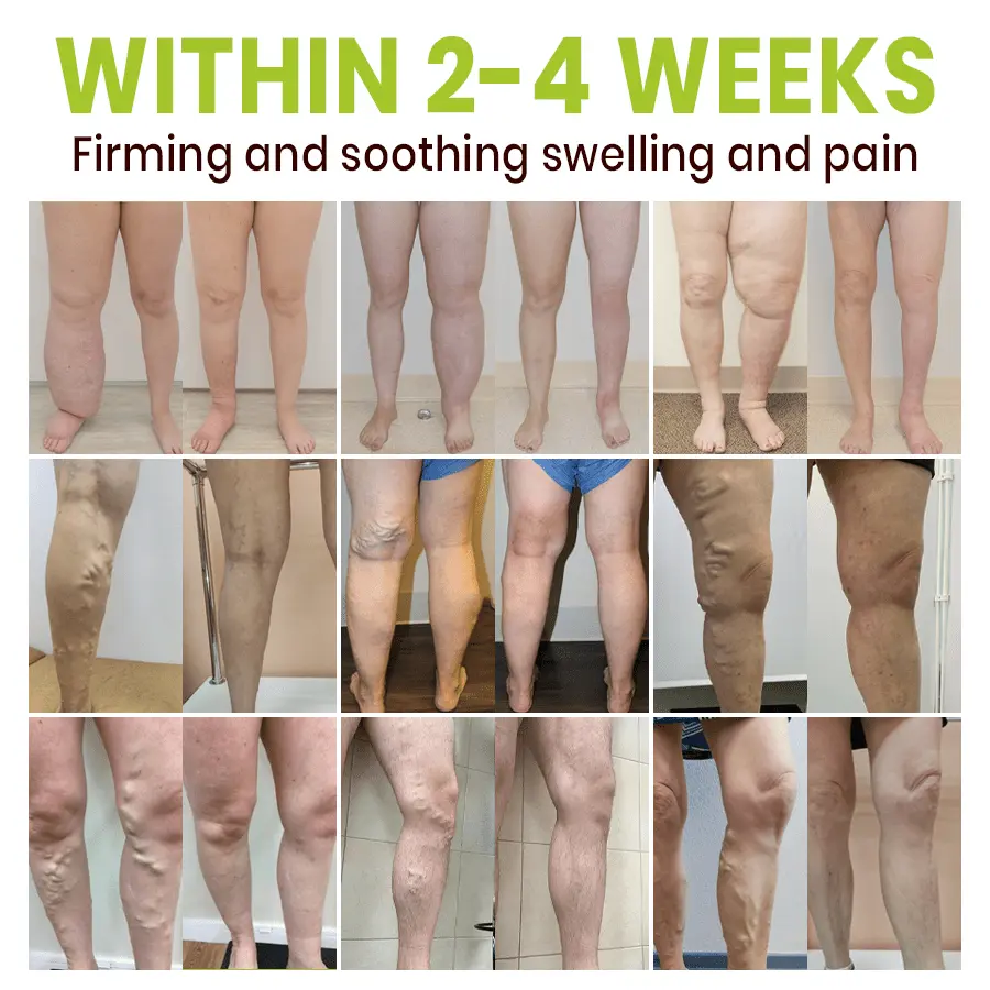 Professional Leg Circulation Cream - Image 2