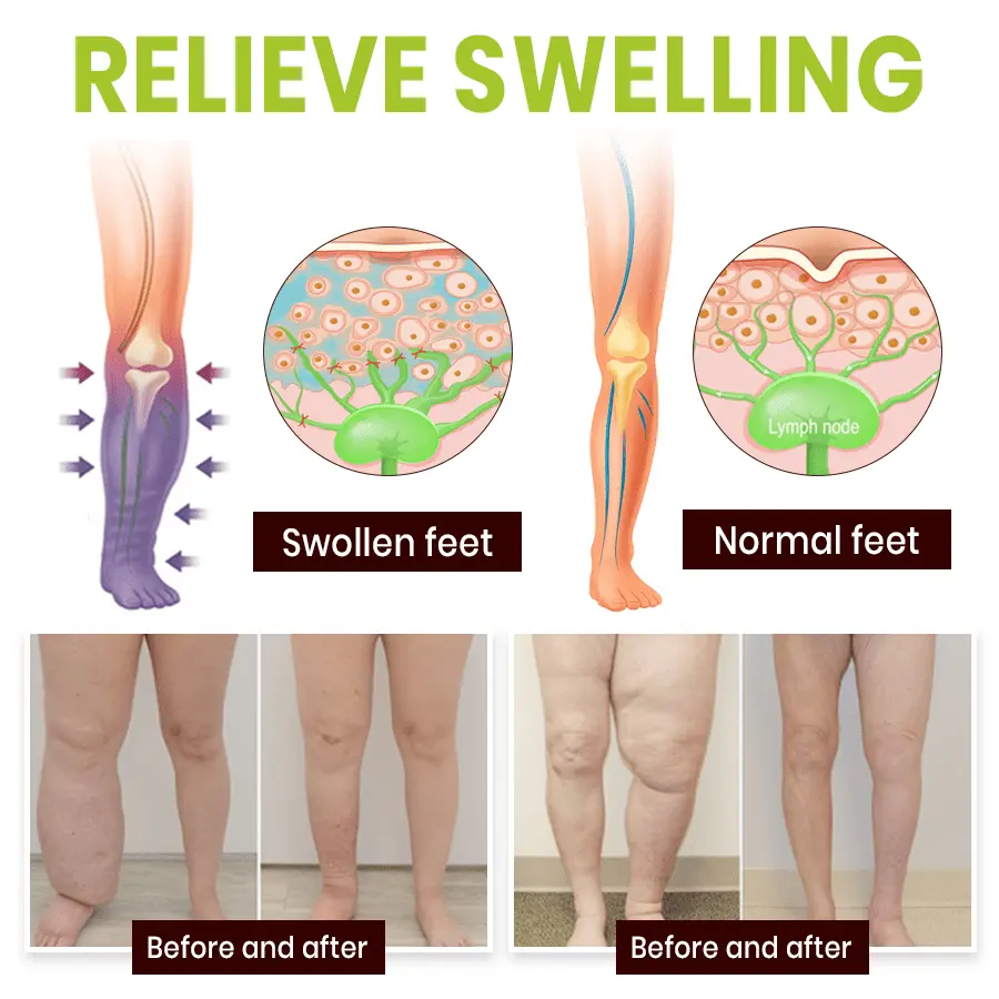 Professional Leg Circulation Cream - Image 4