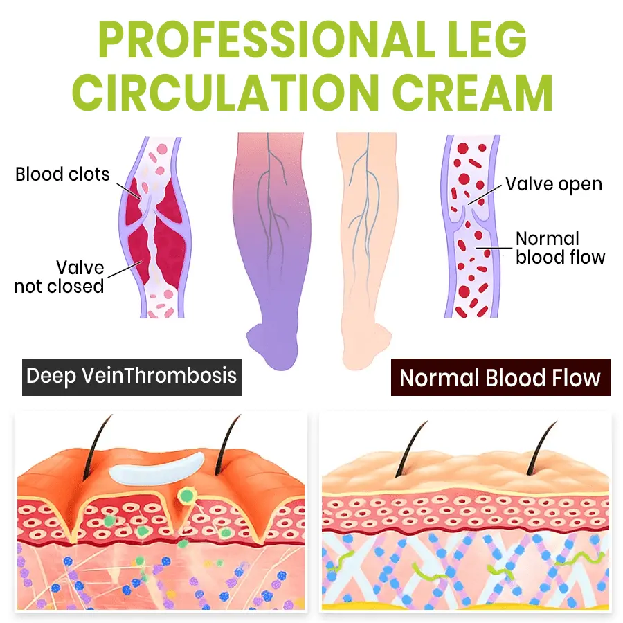 Professional Leg Circulation Cream - Image 6