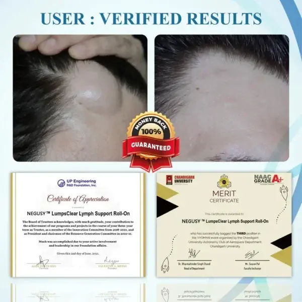 Support Roll-On - Image 5