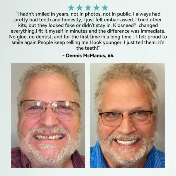 𝐒𝐦𝐚𝐫𝐭 𝐅𝐮𝐥𝐥 𝐃𝐞𝐧𝐭𝐮𝐫🦷 - Image 6