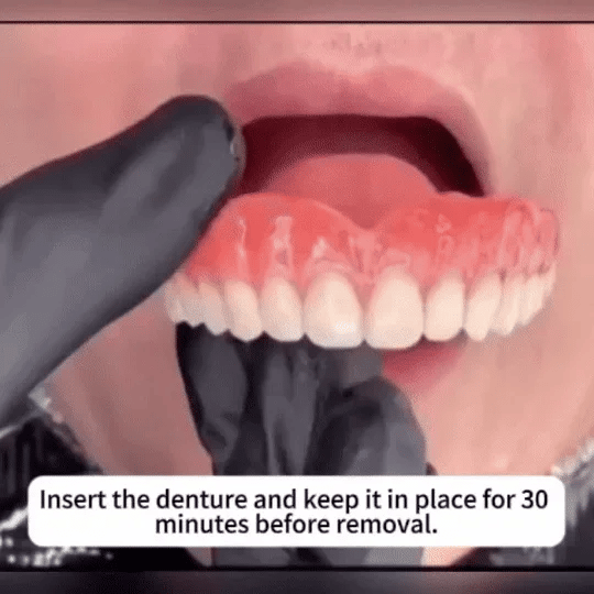 Custom-Fit Full Functional Dentures - Image 10