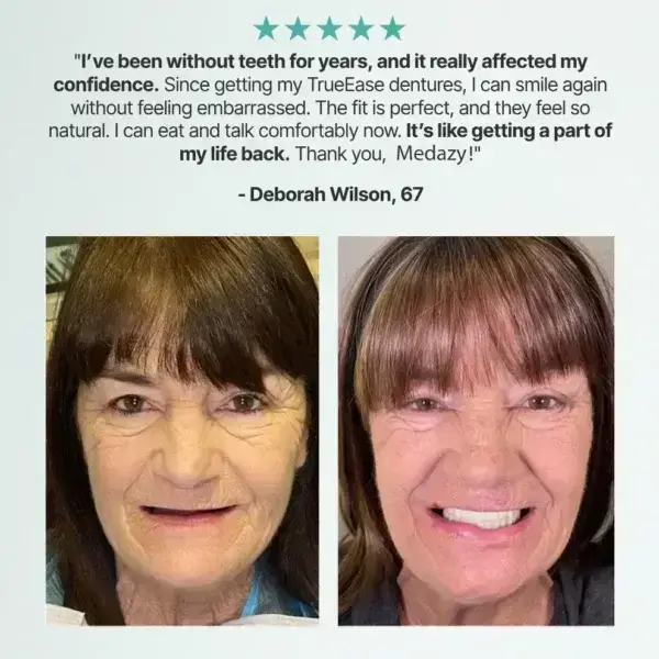 Custom-Fit Full Functional Dentures - Image 3