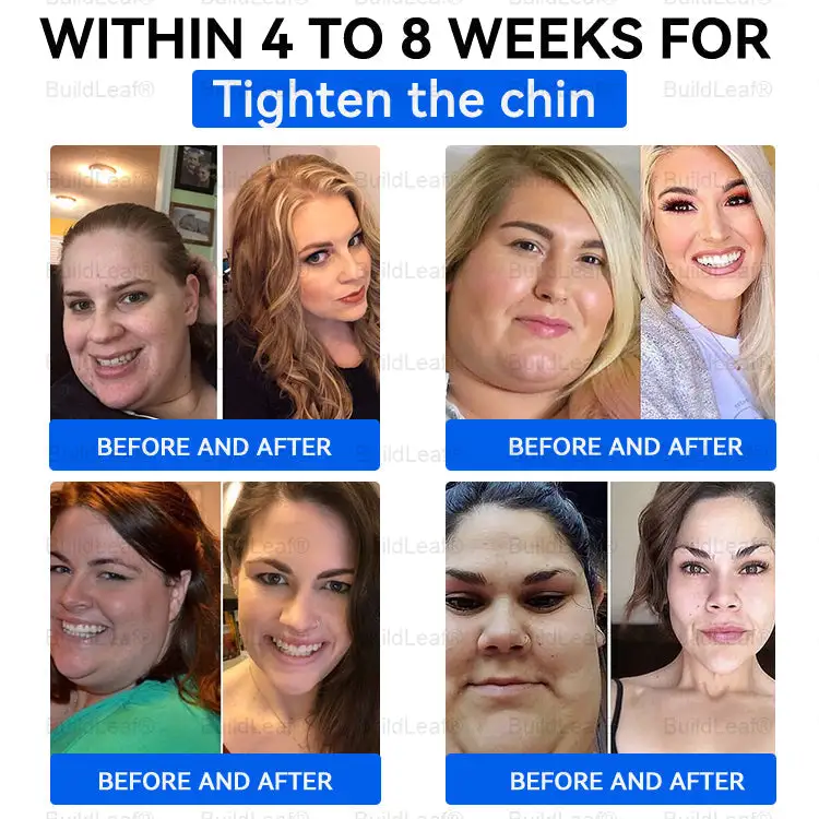 Nano Microneedle Patch - Image 4