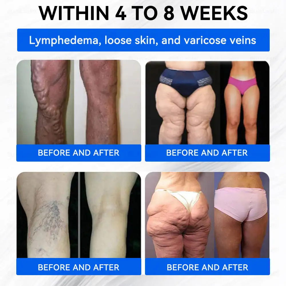 Nano Microneedle Patch - Image 6