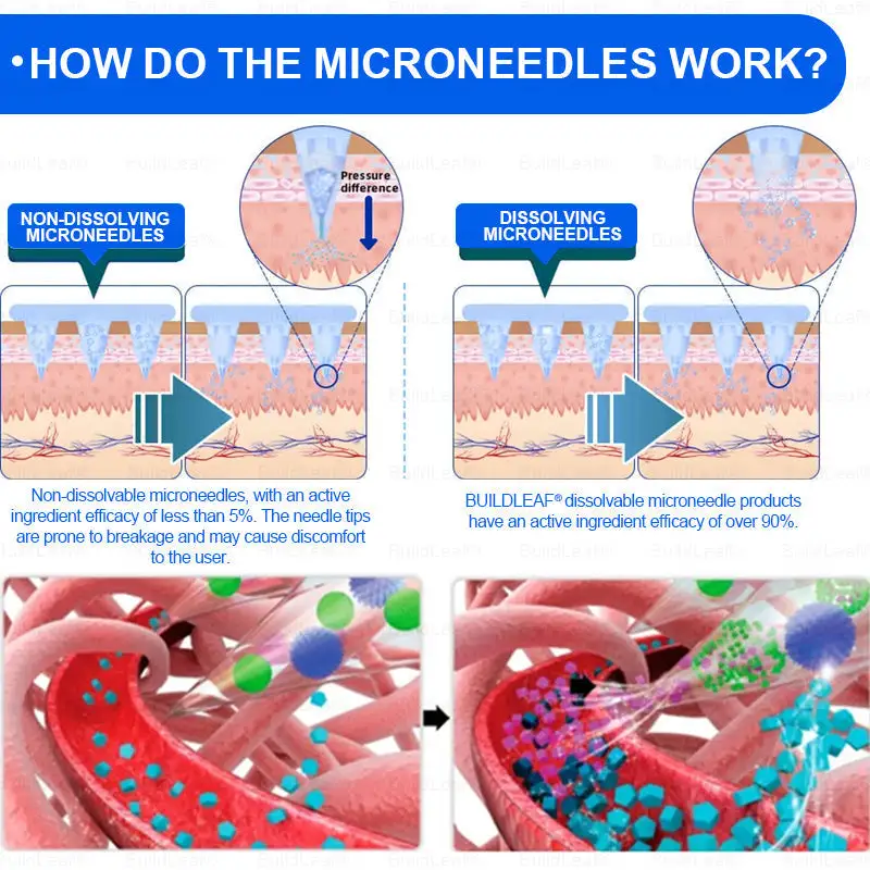 Nano Microneedle Patch - Image 9