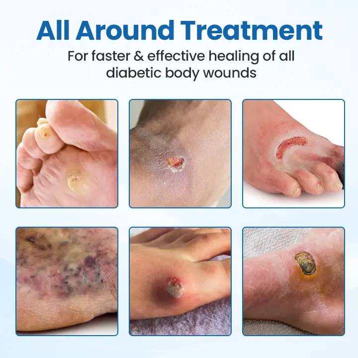 Skin Recovery Band - Image 4