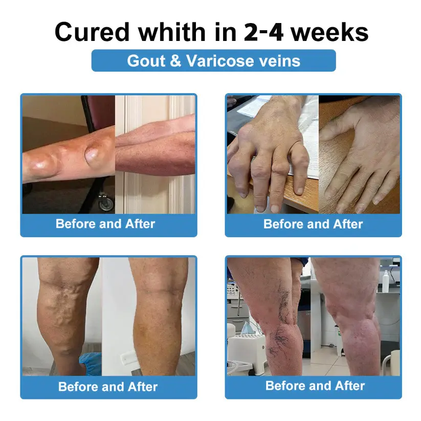 Nano-Microneedle Joint Patch - Image 6