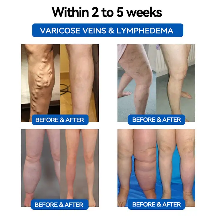 Blood Sugar Balancing - Image 7