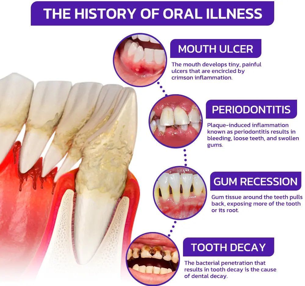 Bee Venom Dental Treatment Toothpaste - Image 9