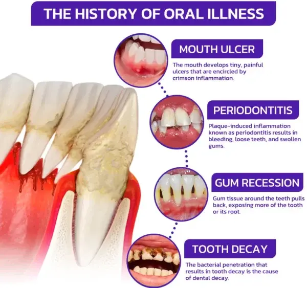 Bee Venom Dental Treatment Toothpaste - Image 9