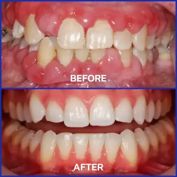 VioGloss Bee Venom Dental Therapy Oral Power🦷 - Image 9