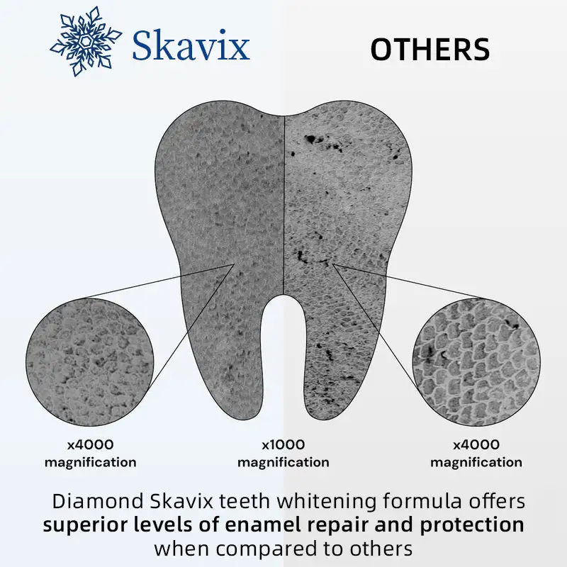 Diamond Teeth Whitening Strips - Image 5