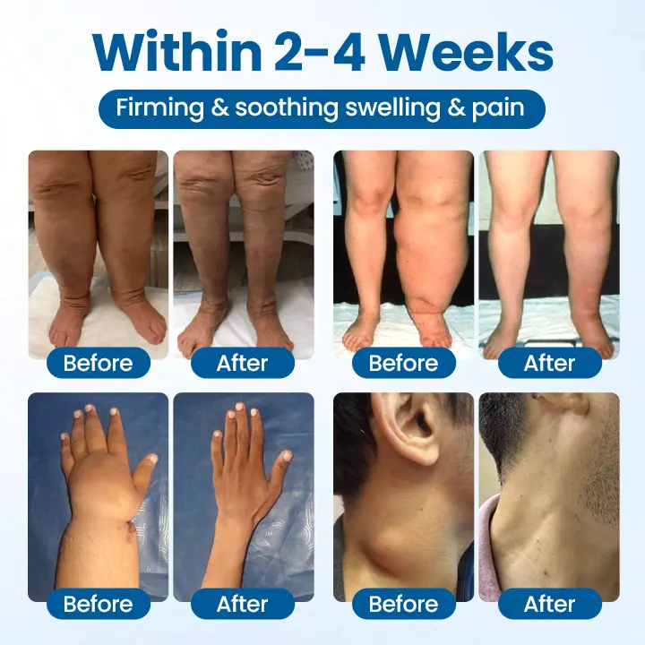 Swelling Relief Roll-On - Image 6