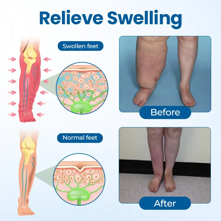 Swelling Relief Roll-On - Image 8