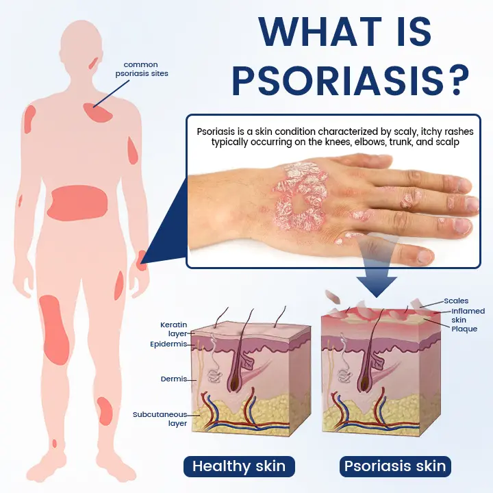 Magnesium Herbal Spray - Image 6