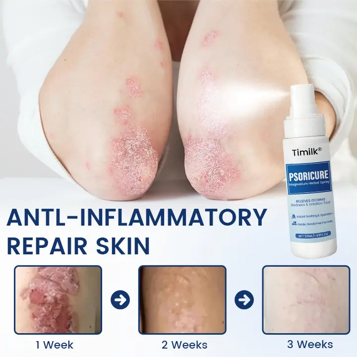 Magnesium Herbal Spray - Image 8